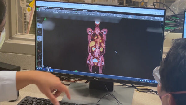 WJLA-TV (ABC) interview on AI in healthcare